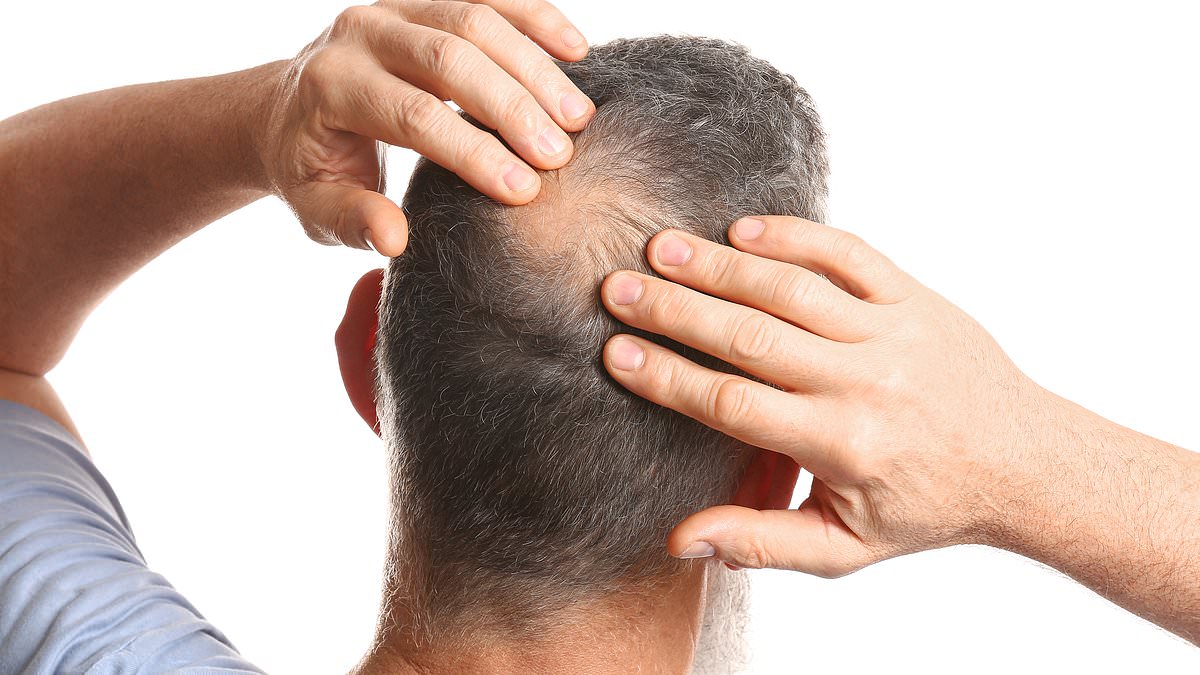 Sugared gel could be the secret to reversing hair loss