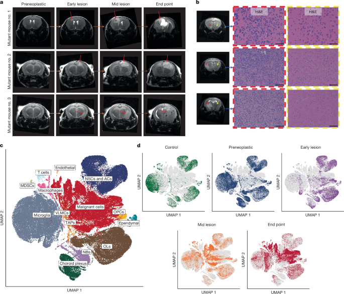 Gliomagenesis mimics an injury response orchestrated by neural crest-like cells