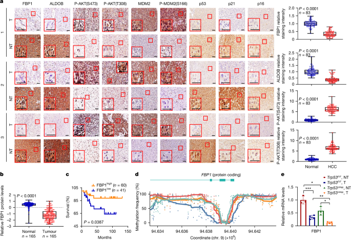 FBP1 controls liver cancer evolution from senescent MASH hepatocytes