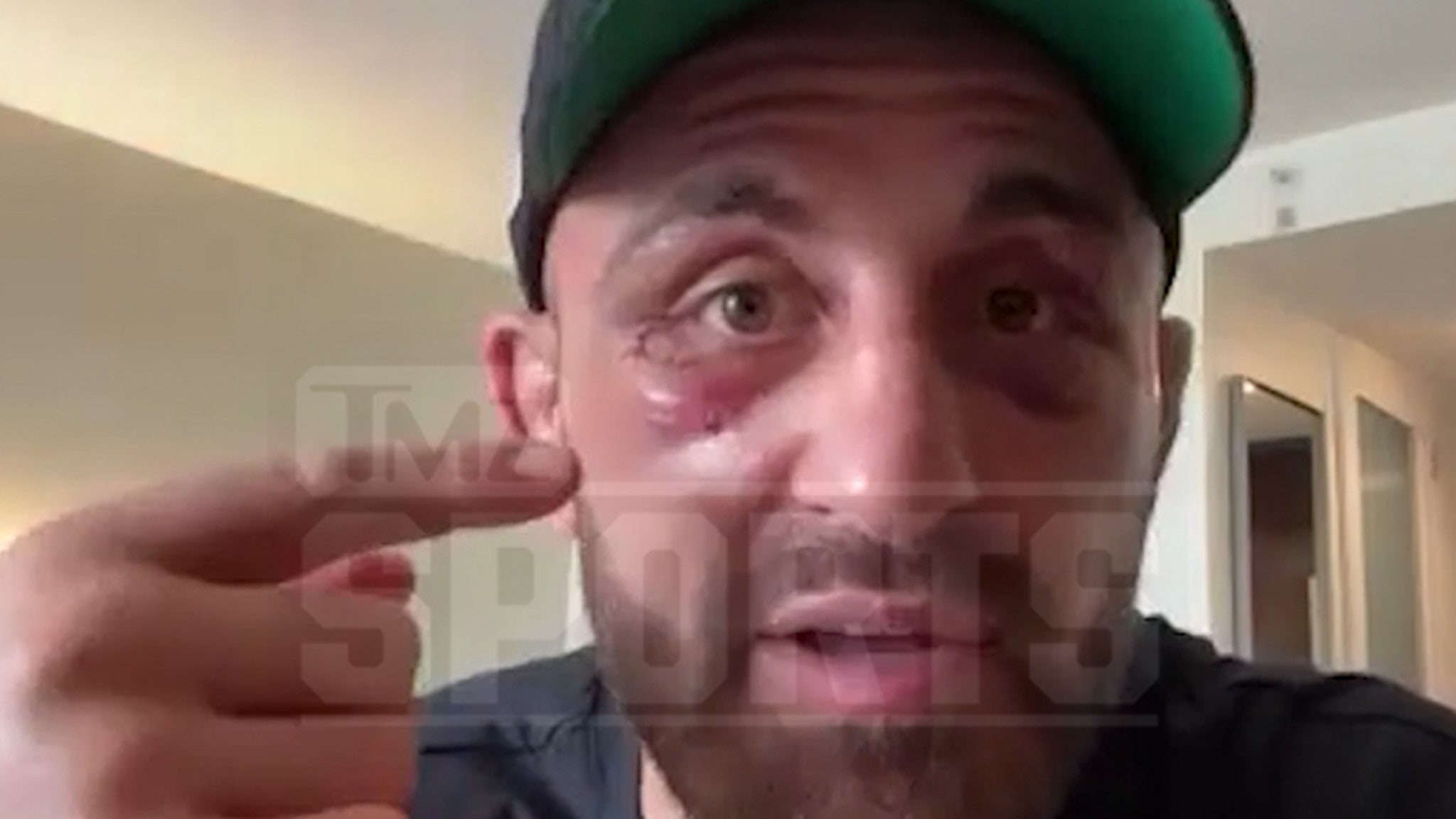 Alex Volkanovski, Fresh Off UFC 314 Win, Says 2nd Title Run Sweeter Than 1st