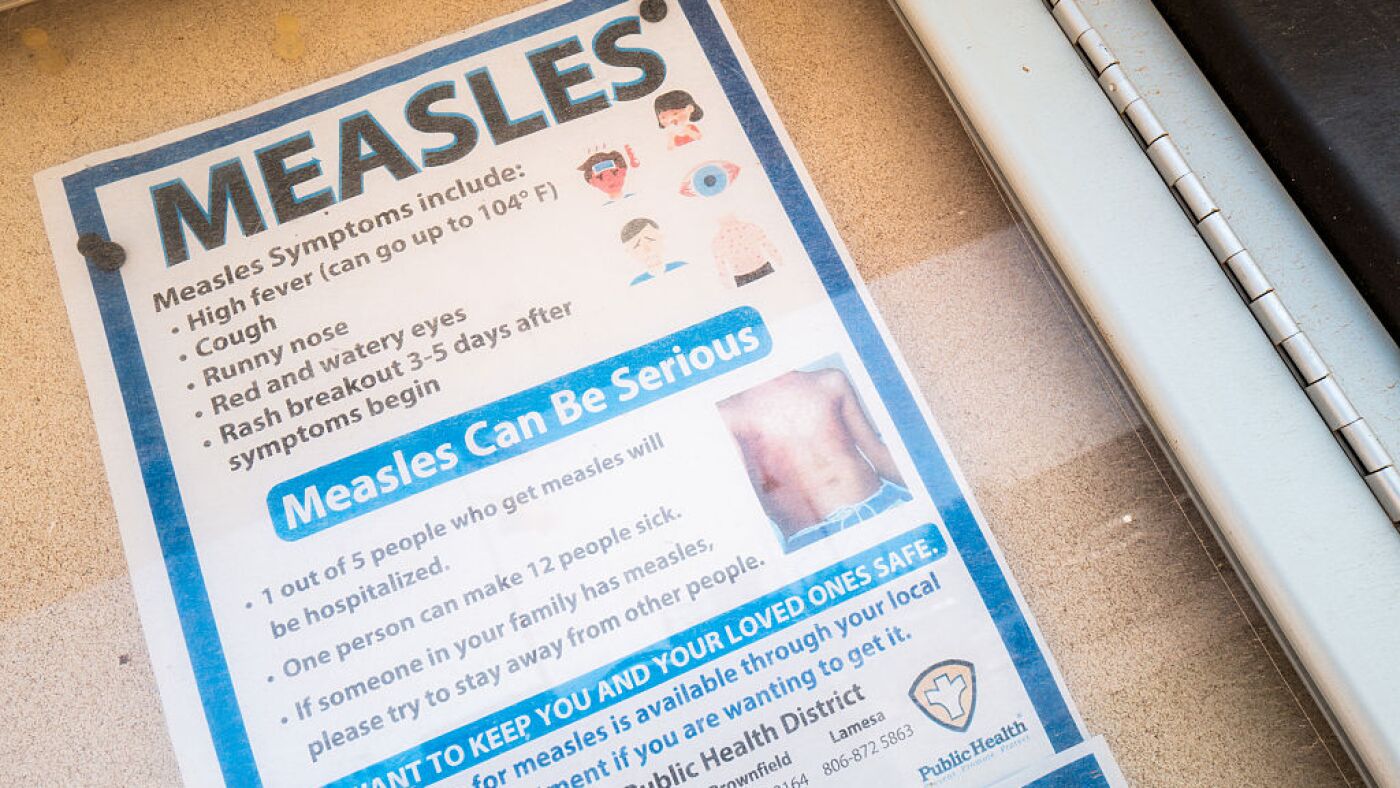 Measles math: What to know about 1,001 measles cases across the country