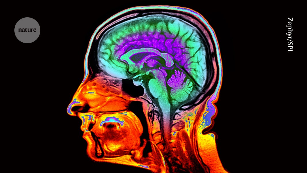 How fast is your brain ageing? Ordinary scans reveal the pace