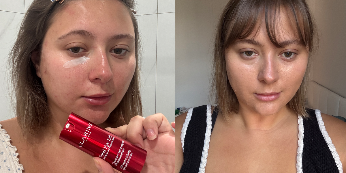 The Best Treatments for Under-Eye Bags Deliver Smooth, Bright Eyes ASAP