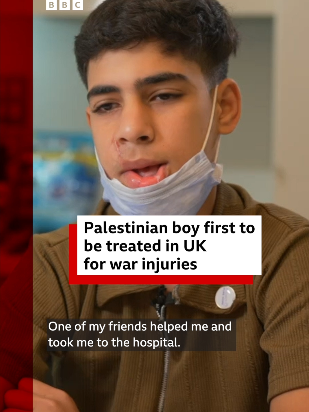 Majd al-Shaghnobi was trying to get humanitarian aid in Gaza last year when an Israeli tank shell exploded nearby. He was evacuated to Egypt - with Israel's permission - for further medical treatment. Now, he's at Great Ormond Street children's hospital in London to restore the function of his face. #Gaza #Israel #GreatOrmondStreetHospital #London #Injuries #Medicine #Health #BBCNews