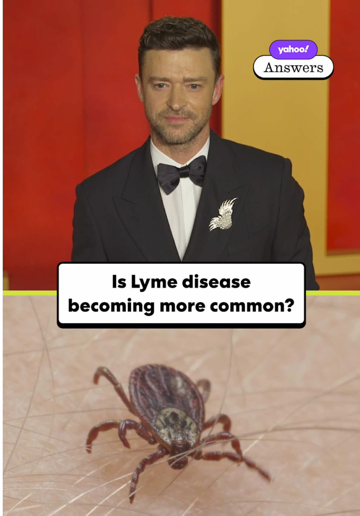 Justin Timberlake is one of hundreds of thousands of Americans who are treated for Lyme each year. Here's what you need to know about the disease.  #news #celebrity #lymedisease #justintimberlake #health