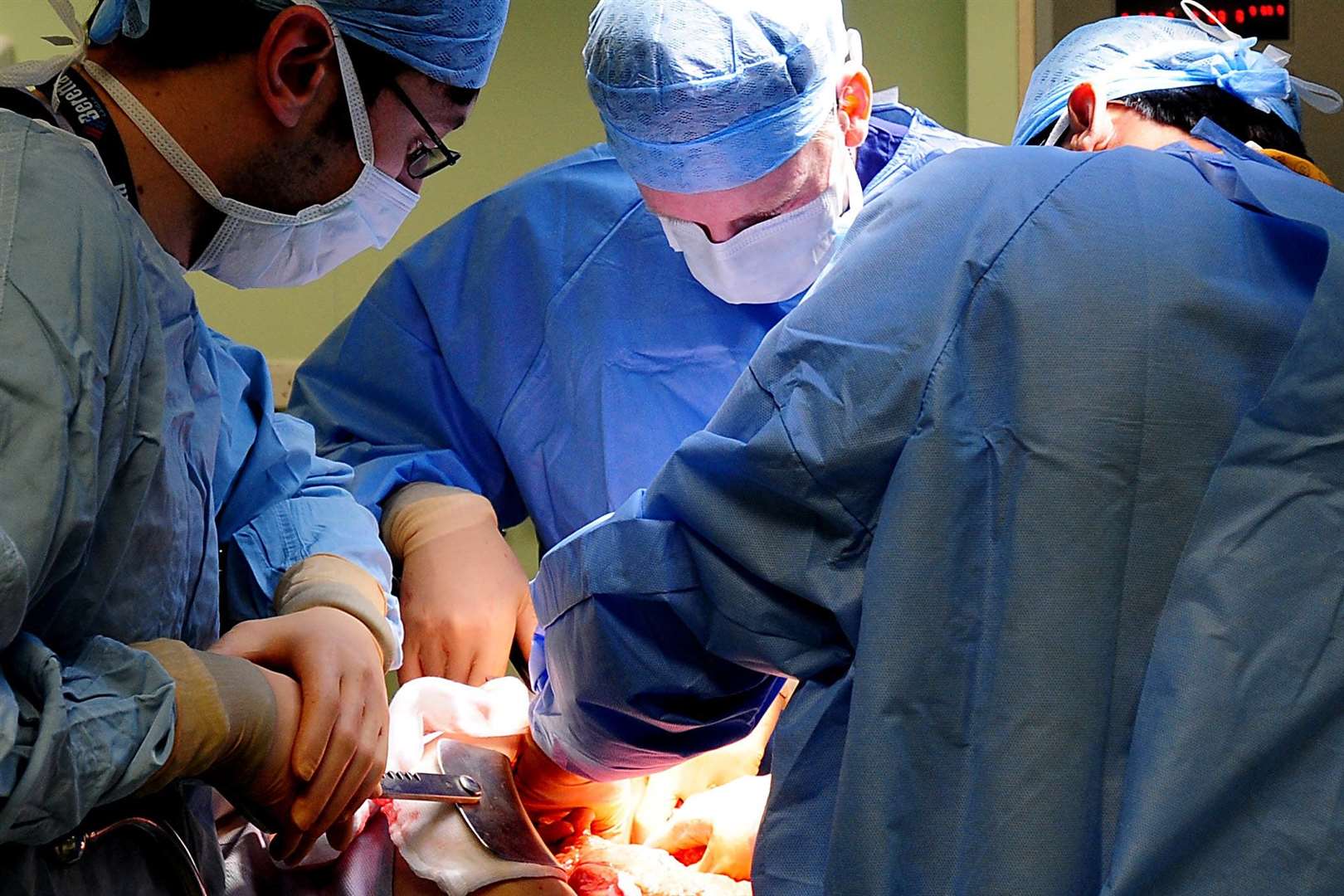 Planned operations total rises – but is still lower than pre-Covid, data shows