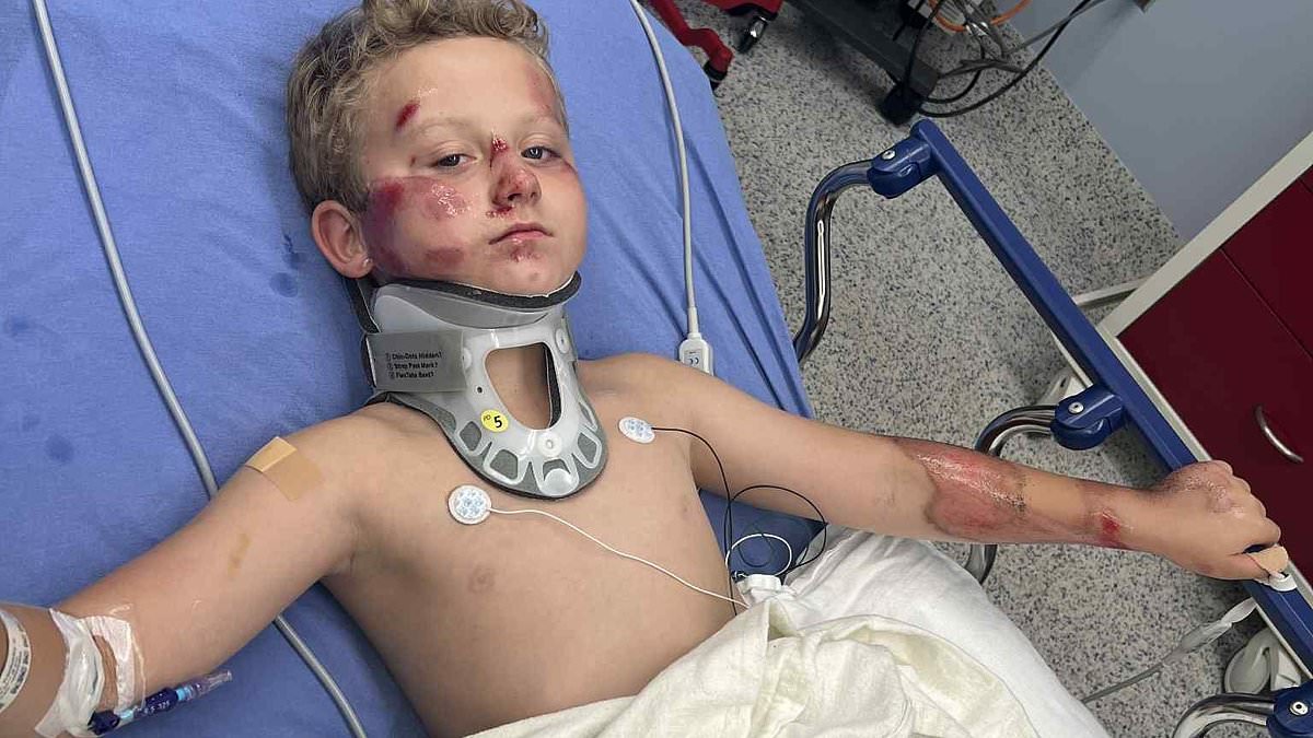 Sweet boy, 8, is left with horrifying injuries after hit-and-run driver mowed him down: 'Blood was everywhere'