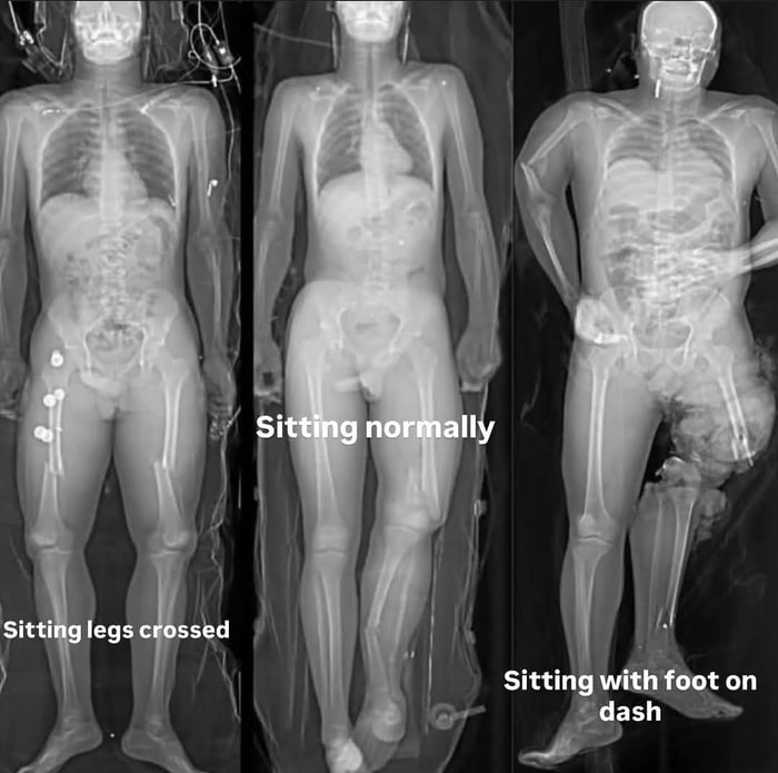 One Crash. Three Postures.