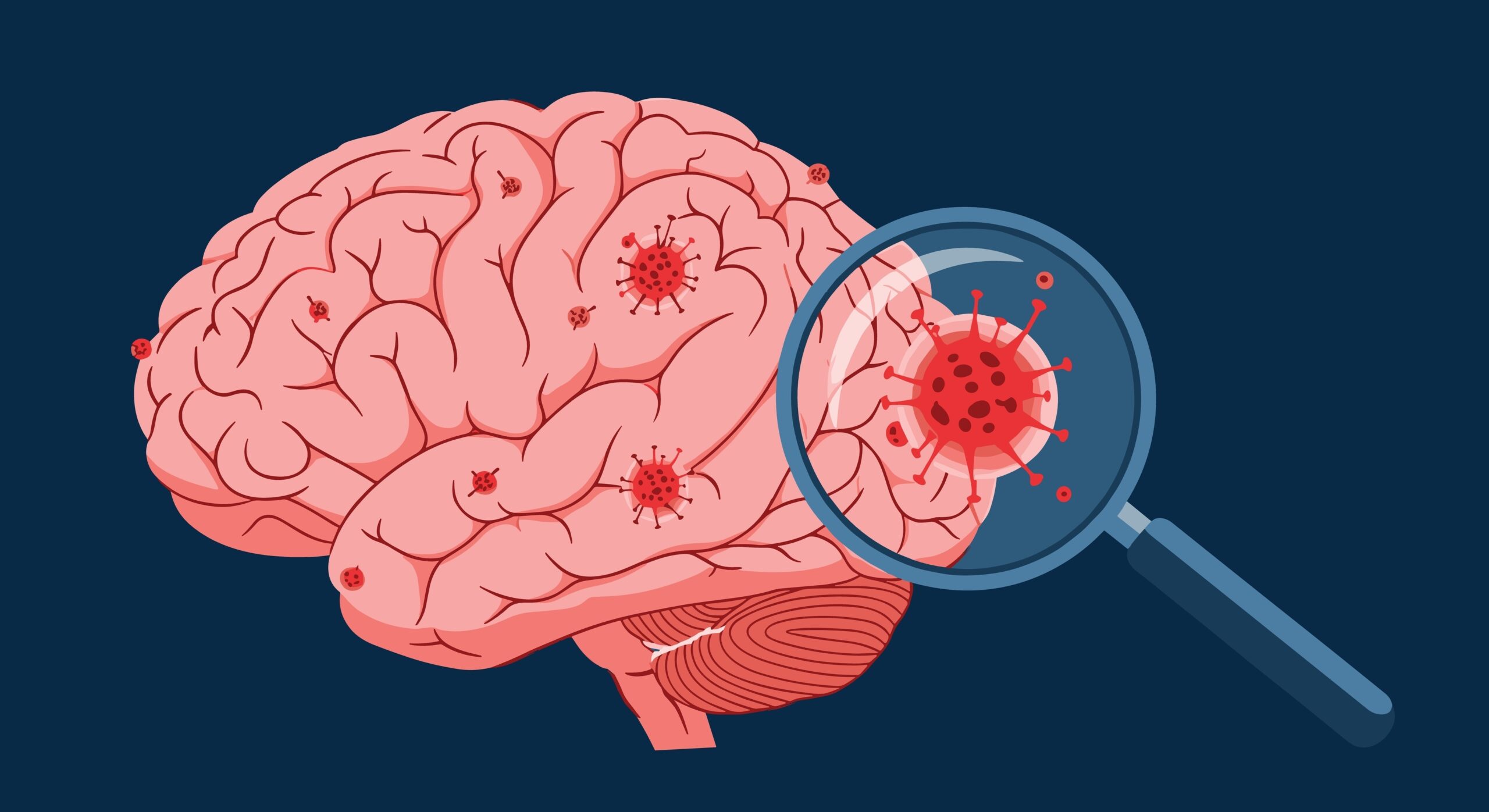 Long COVID is Not Psychosomatic