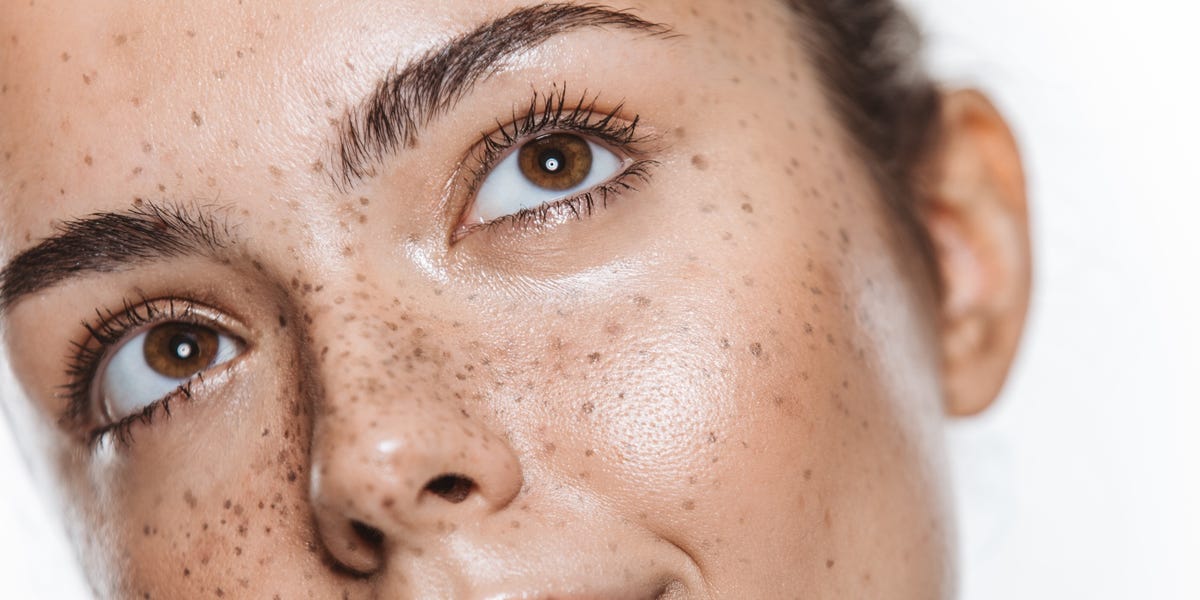 What Plastic Surgeons and Dermatologists Want You to Know About Monopolar Radiofrequency