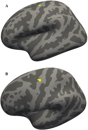 High-magnitude headers are not associated with structural and functional brain changes in active high-level football (soccer) players