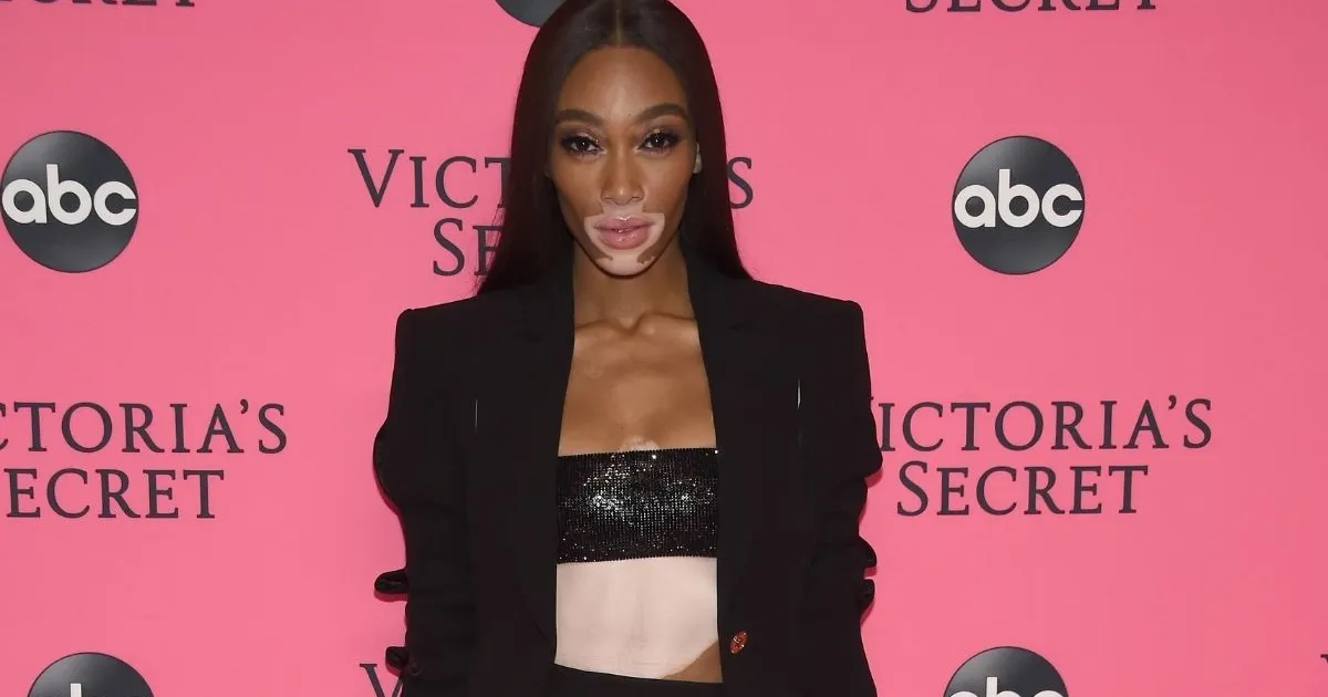 Winnie Harlow Dons Bejeweled Lingerie in Throwback Photo