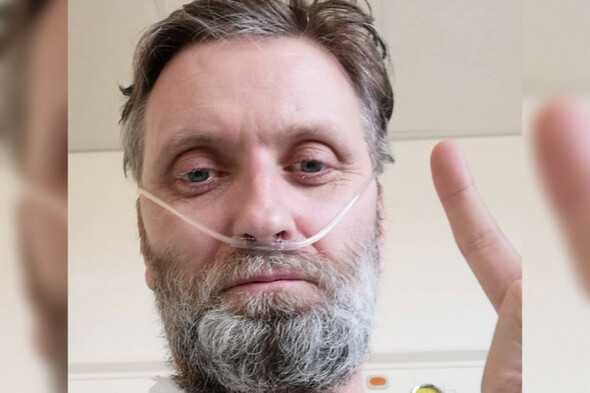 An Irish man became the UK's first Covid ICU survivor - he's turned his tale into a live show