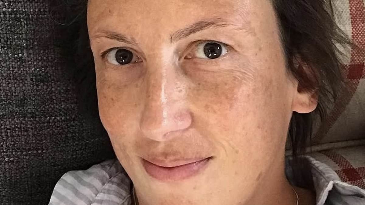 Miranda Hart reveals she has hurt her ankle and can't walk properly as she opens up about her anxiety over her extreme fear of healthcare
