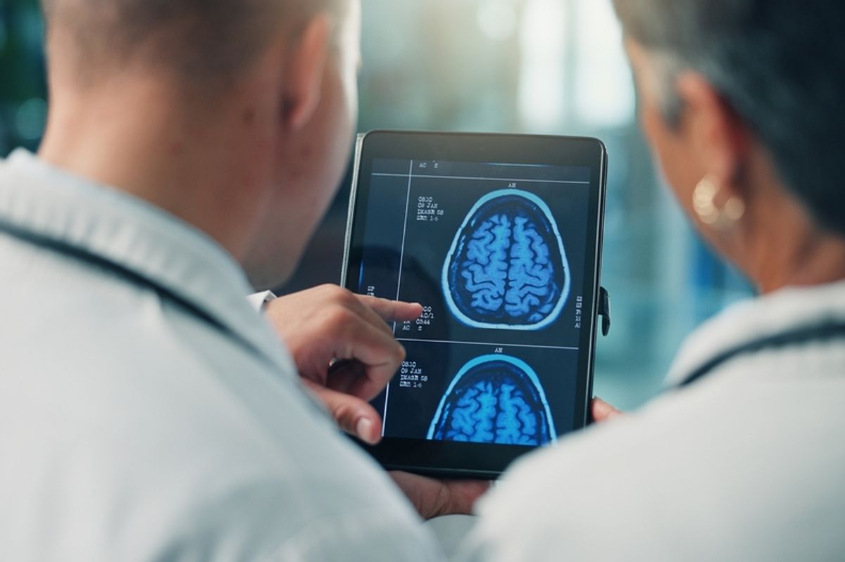 Brain Size Alone Tells Us Little About Intelligence &mdash; Here's What We Know