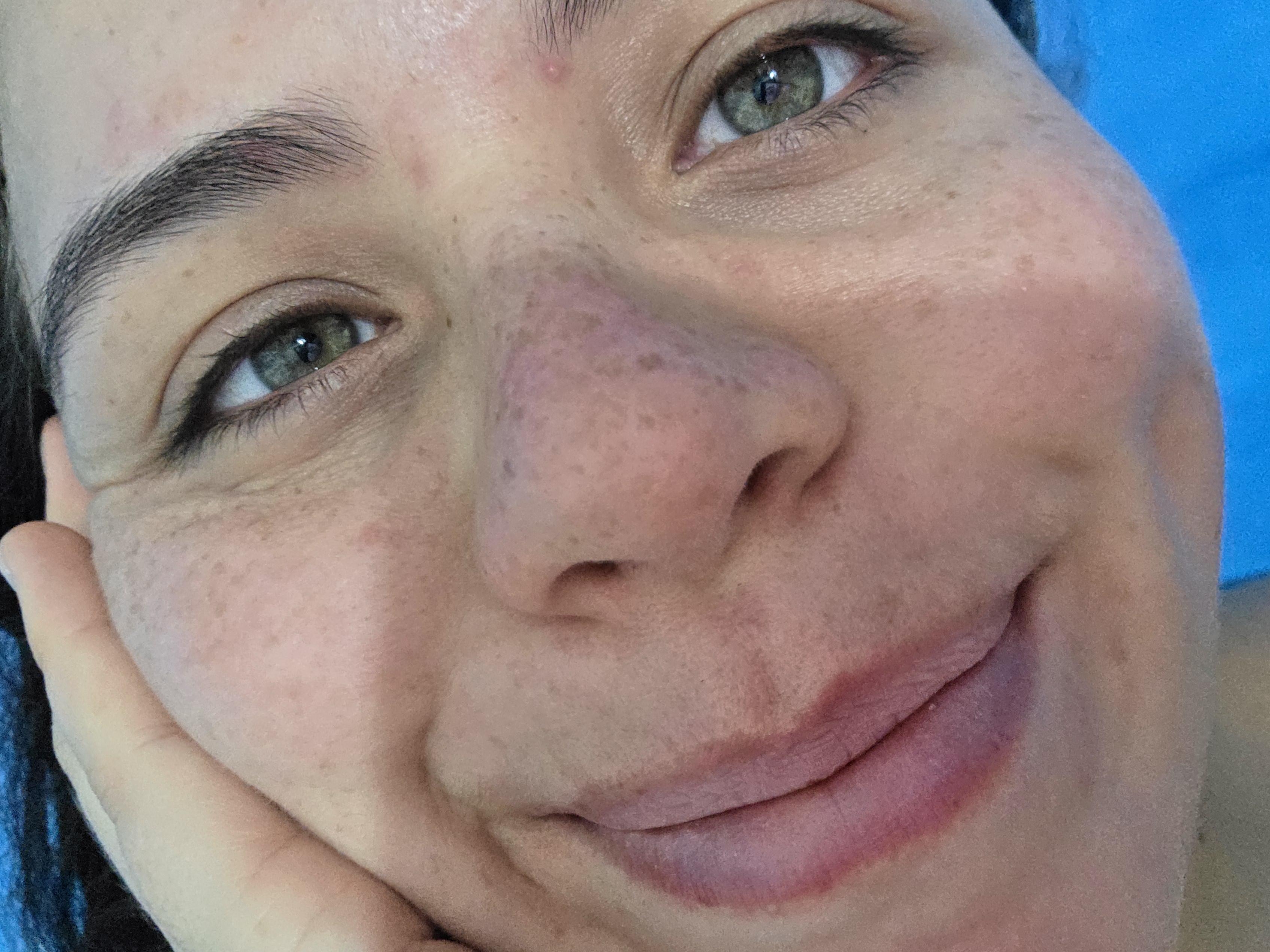 Just a cute freckles without makeup