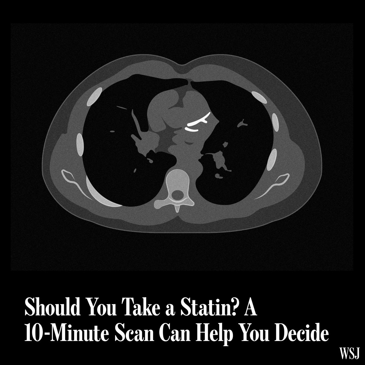 Measuring cholesterol levels has long been the main way doctors assess the risk of heart disease. Increasingly, people are opting, too, for a simple, relatively affordable test: a coronary artery calcium scan. Here’s more to know about the scans: 🔗  pic.