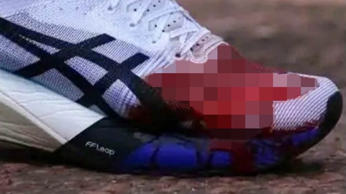 Top British runner's 'foot explodes' during the London Marathon as she reveals gruesome photos - after fighting on to finish in incredible time