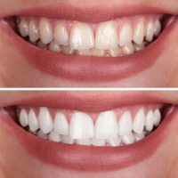 The White Smiles