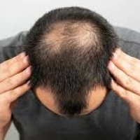 hair transplant in india
